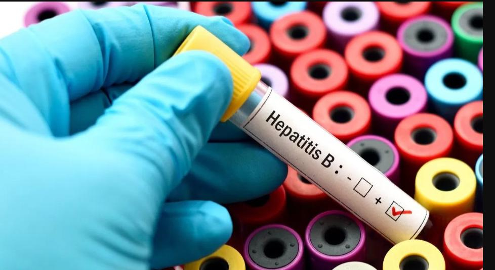 En Buenaventura la Hepatitis B se presenta más en las mujeres