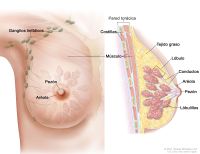 Avances científicos y cáncer de seno